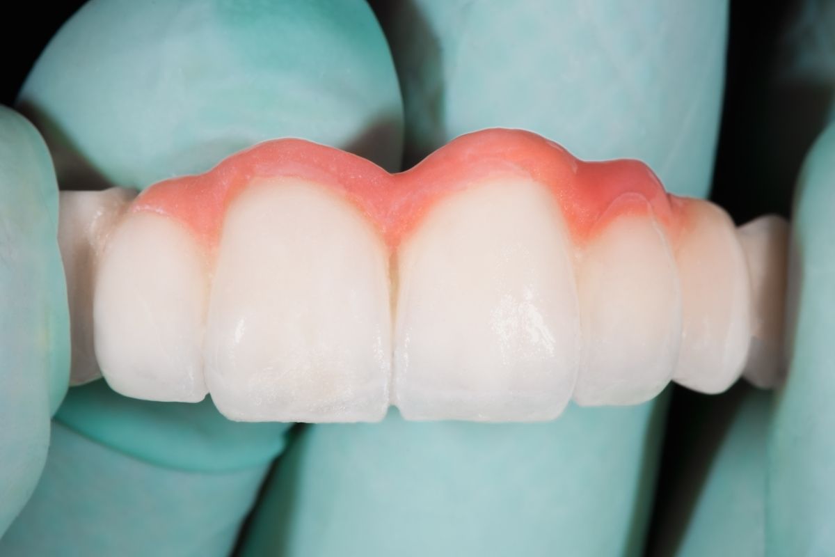 Dental Bridges in Toms River, NJ