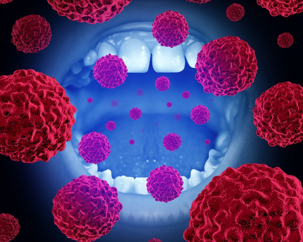 Bacteria caused by poor oral hygiene